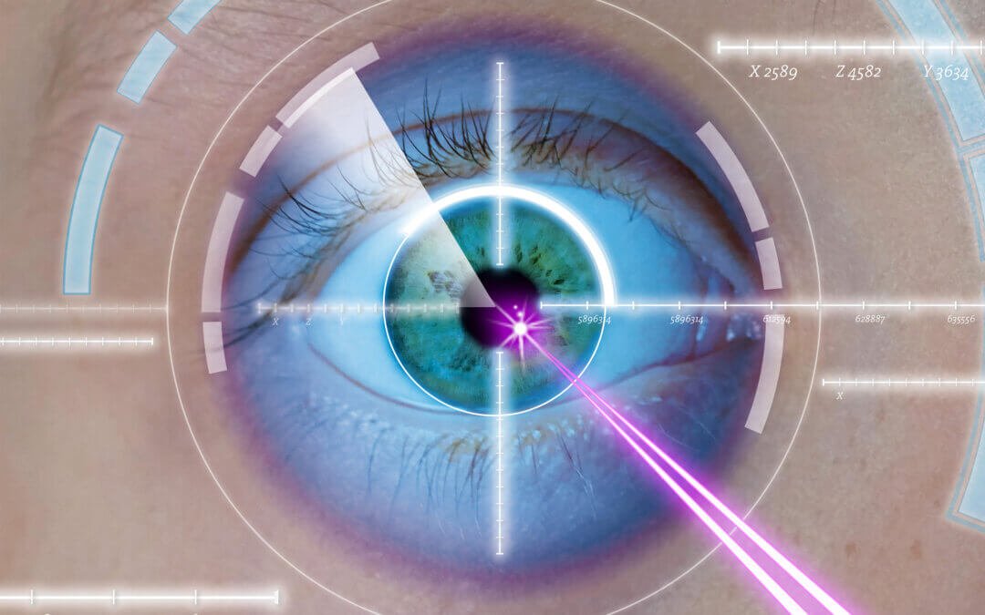 Chirurgie Lasik : 6 étapes pour une vision nette sans lunettes