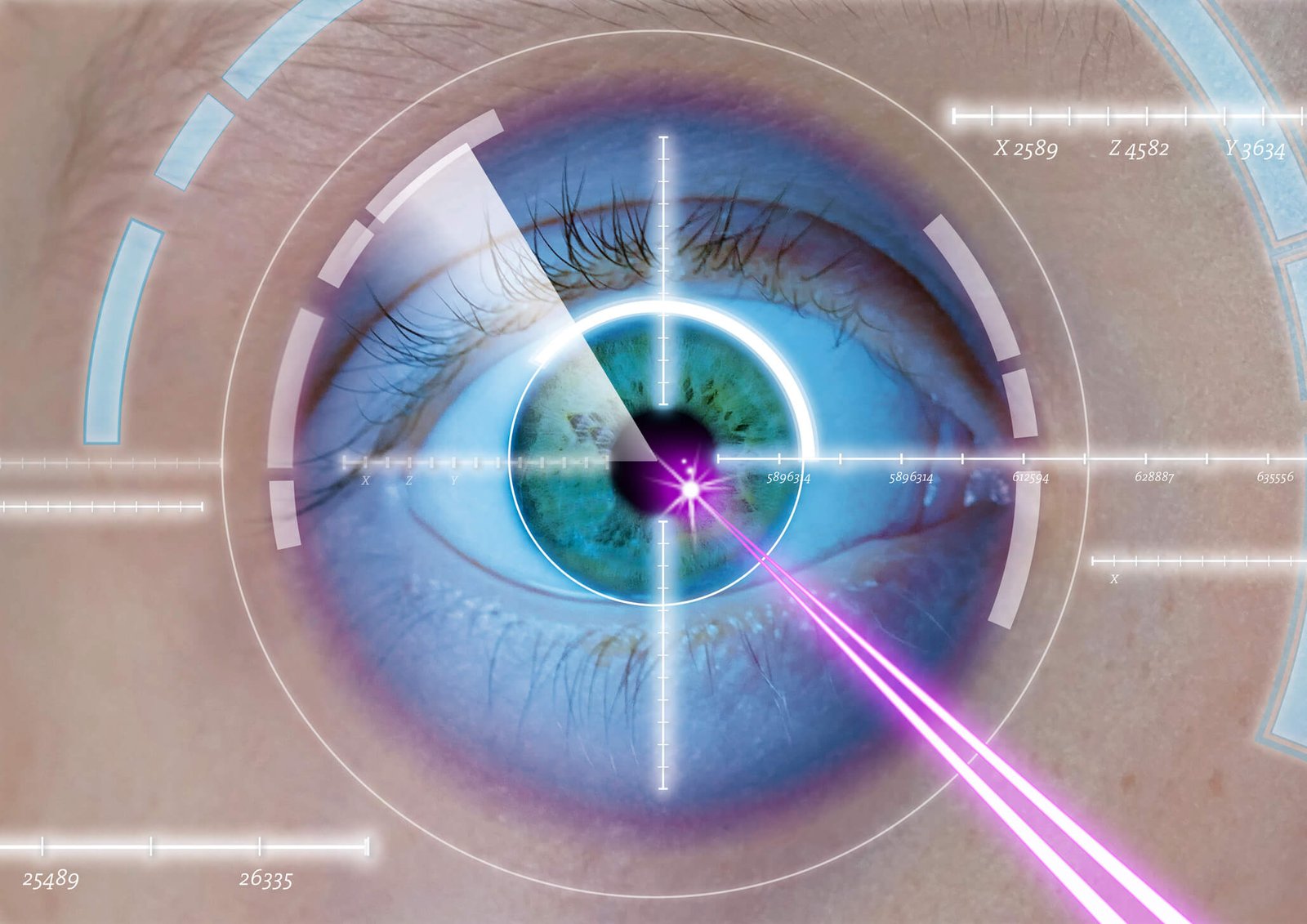 laser-accueil Illustration d'un oeil bénéficiant d'un traitement par chirurgie LASIK
