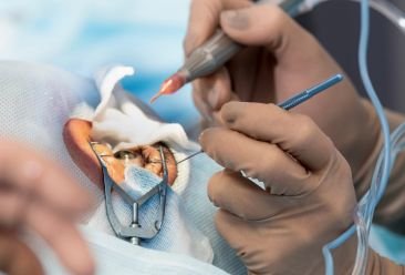 pole-ophtalmologie-colombes-la-defense photo d'un ophtalmologiste réalisant une chirurgie de la cataracte