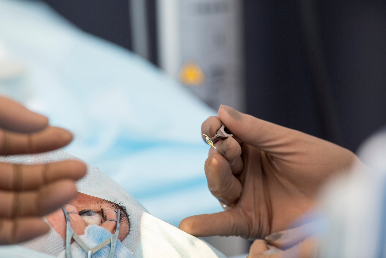pole-ophtalmologie-colombes-la-defense photo d'un ophtalmologiste insérant un implant de caracte au cours d'une chirurgie de la cataracte